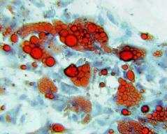 differentiation medium