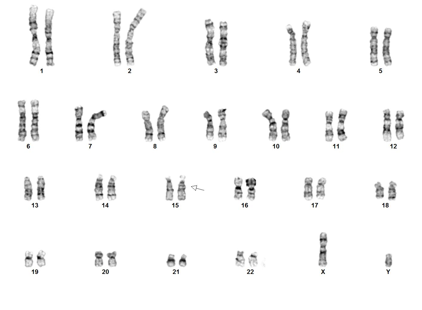 Карта х хромосомы человека